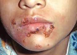 46434198_338476810272948_1727198214500646912_n