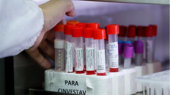 76157_laboratorio-muestras-efe_thumb_586